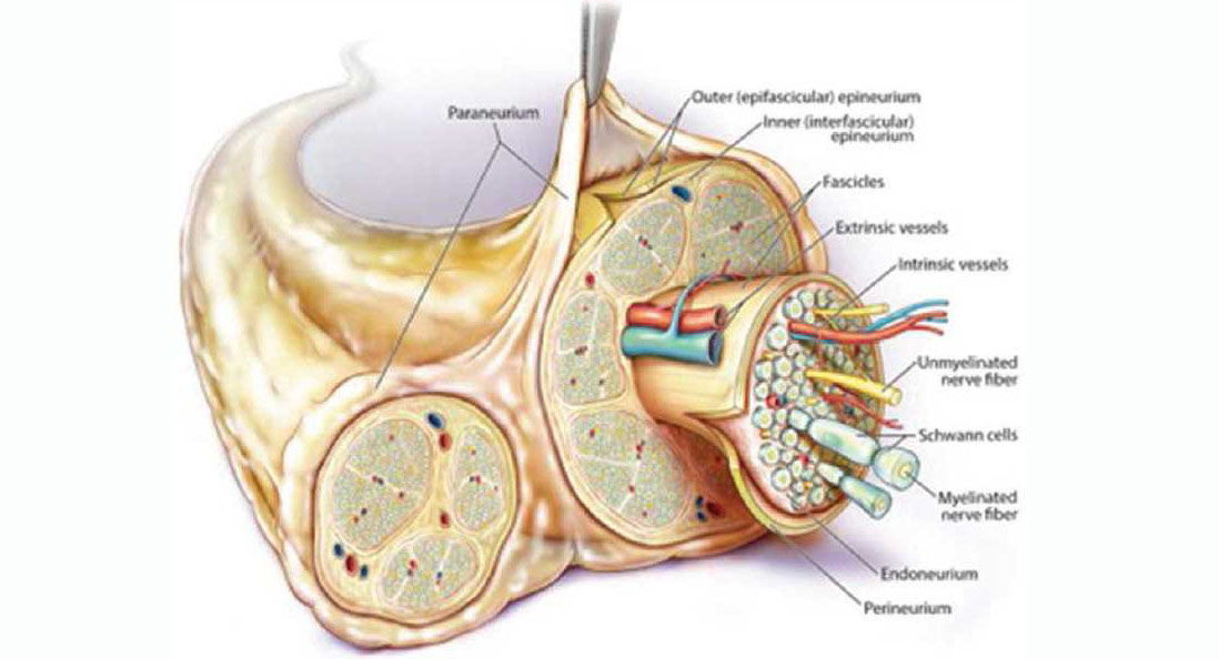 Perioperative Peripheral Nerve Injury Top Neuro Docs