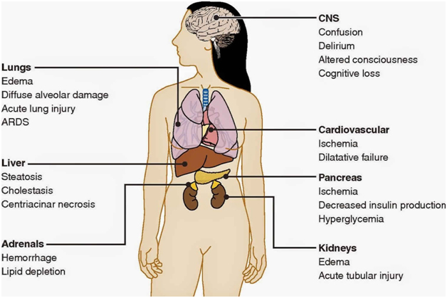 multiple organ dysfunction syndrome