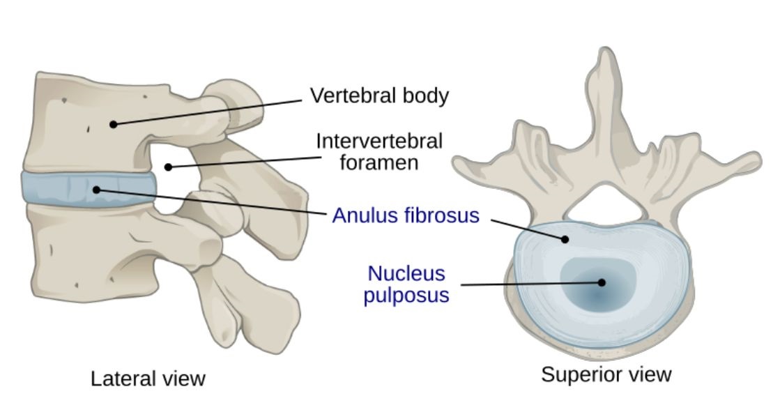 Infection of the Spine | Top Neuro Docs
